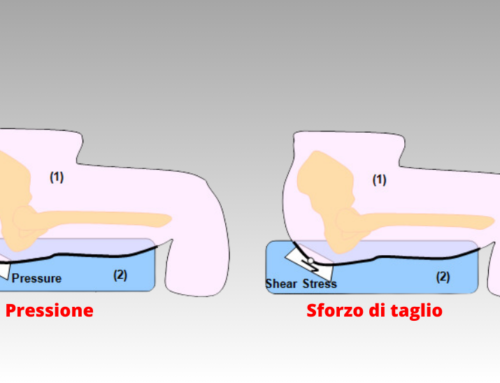 Pressione, Frizione e Taglio: Un Triangolo di Rischi per la Pelle