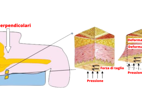 Quale cuscino antidecubito scegliere? La gestione della pressione